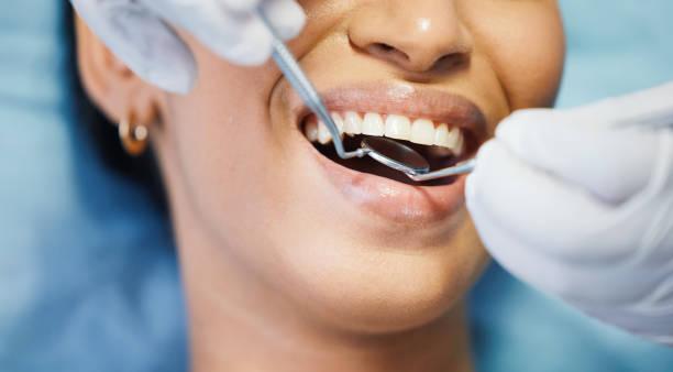 Best Emergency Dental Care  in Zebulon, GA